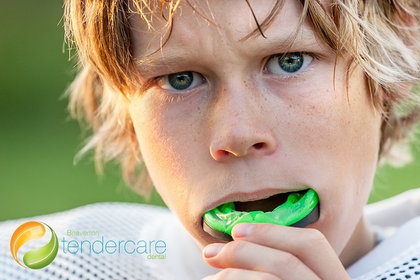 Custom Mouth Guards at Beaverton TenderCare in Beaverton, OR. Dr. Lennie D. Wong, DMD, FAGD, Dr. Maikhanh (MK) Tran, DMD. Beaverton TenderCare